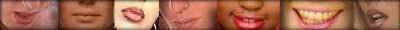 labios-bocas-dientes-013.jpg