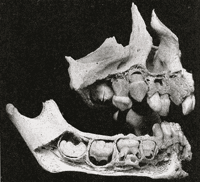huesos-anatomia-para-artistas-014.gif