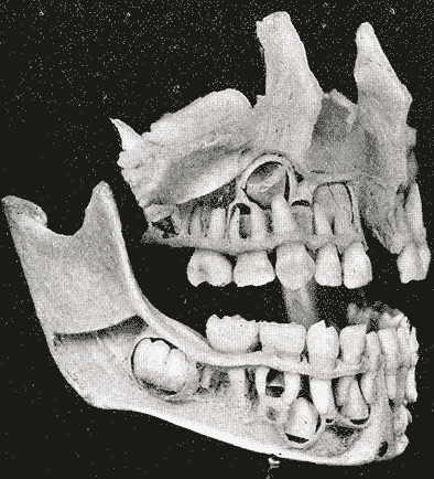 huesos-anatomia-para-artistas-023.gif
