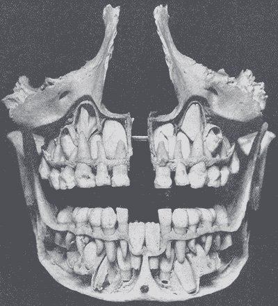 huesos-anatomia-para-artistas-026.gif
