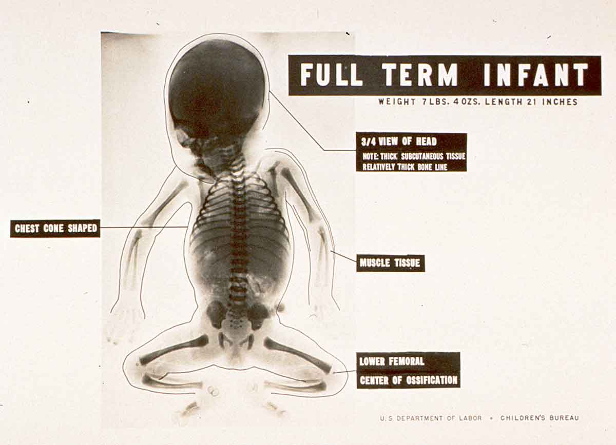 natalidad-anatomia-para-artistas-007.jpg